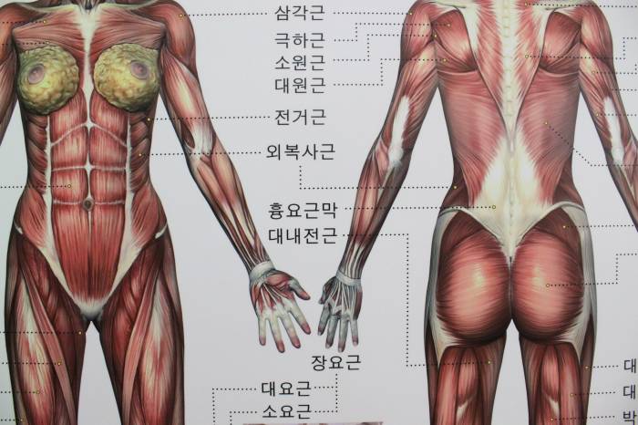 인체근육 해부도 - 체형 상담용 대형 [인체근육 해부도] 액자 판매